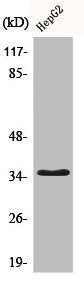 Western Blot analysis of HepG2 cells using CD34 Polyclonal Antibody