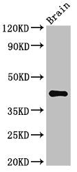 Western Blot Positive WB detected in: Mouse brain tissue All lanes: AGPAT5 antibody at 3.4ug/ml Secondary Goat polyclonal to rabbit IgG at 1/50000 dilution Predicted band size: 43 kDa Observed band size: 43 kDa
