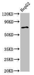 Western Blot Positive WB detected in: HepG2 whole cell lysate All lanes: AGPS antibody at 2.7µg/ml Secondary Goat polyclonal to rabbit IgG at 1/50000 dilution Predicted band size: 73 kDa Observed band size: 73 kDa