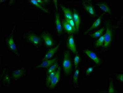Immunofluorescence staining of Hela cells with CSB-PA001461LA01HU at 1:133, counter-stained with DAPI. The cells were fixed in 4% formaldehyde, permeabilized using 0.2% Triton X-100 and blocked in 10% normal Goat Serum. The cells were then incubat...