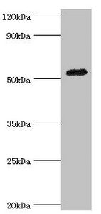 Western blot All lanes: Angiotensinogen antibody at 3ug/ml + Mouse liver tissue Secondary Goat polyclonal to rabbit IgG at 1/10000 dilution Predicted band size: 53 kDa Observed band size: 53 kDa
