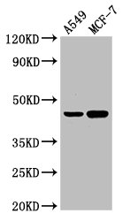 Western Blot Positive WB detected in: A549 whole cell lysate, MCF-7 whole cell lysate All lanes: AGXT antibody at 3µg/ml Secondary Goat polyclonal to rabbit IgG at 1/50000 dilution Predicted band size: 44 kDa Observed band size: 44 kDa
