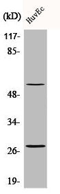 Western Blot analysis of HuvEc cells using CD69 Polyclonal Antibody