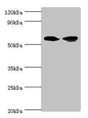 Western blot All lanes: AHCYL1 antibody at 12ug/ml Lane 1: Hela whole cell lysate Lane 2: 293T whole cell lysate Secondary Goat polyclonal to rabbit IgG at 1/10000 dilution Predicted band size: 59, 54 kDa Observed band size: 59 kDa