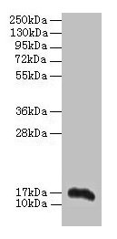 Western blot All lanes: Aif1 antibody at 2µg/ml + THP-1 whole cell lysate Secondary Goat polyclonal to rabbit IgG at 1/10000 dilution Predicted band size: 17 kDa Observed band size: 17 kDa