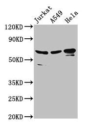 Western Blot Positive WB detected in: Jurkat whole cell lysate, A549 whole cell lysate, Hela whole cell lysate All lanes: AIFM1 antibody at 2.8µg/ml Secondary Goat polyclonal to rabbit IgG at 1/50000 dilution Predicted band size: 67, 36, 29, 27 kD...
