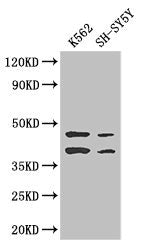 Western Blot Positive WB detected in: K562 whole cell lysate, SH-SY5Y whole cell lysate All lanes: AIM2 antibody at 2.7ug/ml Secondary Goat polyclonal to rabbit IgG at 1/50000 dilution Predicted band size: 39 kDa Observed band size: 39, 45 kDa