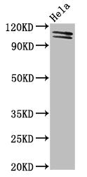 Western Blot Positive WB detected in: Hela whole cell lysate All lanes: UBA1 antibody at 2µg/ml Secondary Goat polyclonal to rabbit IgG at 1/50000 dilution Predicted band size: 118, 114 kDa Observed band size: 118, 114 kDa