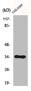 Western Blot analysis of COLO205 cells using Cdc34 Polyclonal Antibody