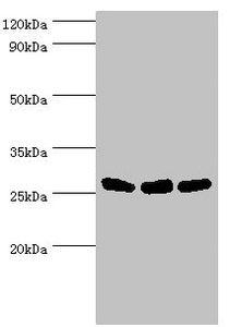 Western blot All lanes: Adenylate kinase 2, mitochondrial antibody at 5ug/ml Lane 1: Hela whole cell lysate Lane 2: Mouse kidney tissue Lane 3: Mouse small intestine tissue Secondary Goat polyclonal to rabbit IgG at 1/10000 dilution Predicted band...
