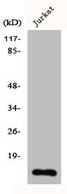 Western Blot analysis of Jurkat cells using Cdc42EP5 Polyclonal Antibody