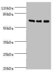 Western blot All lanes: AKAP10 antibody at 7ug/ml Lane 1: 293T whole cell lysate Lane 2: Hela whole cell lysate Lane 3: HepG2 whole cell lysate Secondary Goat polyclonal to rabbit IgG at 1/10000 dilution Predicted band size: 74 kDa Observed band s...