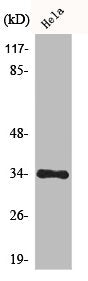 Western Blot analysis of COLO205 cells using Cdk1/2/3 Polyclonal Antibody