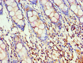 Immunohistochemistry of paraffin-embedded human colon tissue using CSB-PA001527ESR2HU at dilution of 1:100