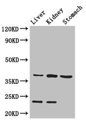 Western Blot Positive WB detected in: Mouse liver tissue, Mouse kidney tissue, Mouse stomach tissue All lanes: Akr1a1 antibody at 2.8ug/ml Secondary Goat polyclonal to rabbit IgG at 1/50000 dilution Predicted band size: 37 kDa Observed band size:...