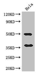 Western Blot Positive WB detected in: Hela whole cell lysate All lanes: AKR1B1 antibody at 3ug/ml Secondary Goat polyclonal to rabbit IgG at 1/50000 dilution Predicted band size: 36 kDa Observed band size: 36, 50 kDa