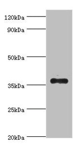 Western blot All lanes: AKR1B10 antibody at 4µg/ml + A549 whole cell lysate Secondary Goat polyclonal to rabbit IgG at 1/10000 dilution Predicted band size: 36 kDa Observed band size: 36 kDa