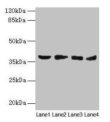 Western blot All lanes: AKR1C2 antibody at 14µg/ml Lane 1: HepG2 whole cell lysate Lane 2: MCF-7 whole cell lysate Lane 3: Hela whole cell lysate Lane 4: Rat liver tissue Secondary Goat polyclonal to rabbit IgG at 1/10000 dilution Predicted band s...