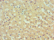 Immunohistochemistry of paraffin-embedded human liver tissue using CSB-PA001545ESR1HU at dilution of 1:100