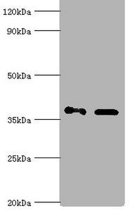 Western blot All lanes: Aldo-keto reductase family 1 member C4 antibody at 7ug/ml Lane 1: Hela whole cell lysate Lane 2: HepG 2 whole cell lysate Secondary Goat polyclonal to rabbit IgG at 1/10000 dilution Predicted band size: 37 kDa Observed band...