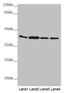 Western blot All lanes: AKR7A2 antibody at 0.88µg/ml Lane 1: Mouse small intestine tissue Lane 2: Mouse liver tissue Lane 3: Mouse gonadal tissue Lane 4: A431 whole cell lysate Secondary Goat polyclonal to rabbit IgG at 1/10000 dilution Predicted...