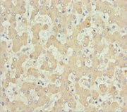 Immunohistochemistry of paraffin-embedded human liver tissue using CSB-PA001550ESR2HU at dilution of 1:100