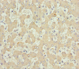 Immunohistochemistry of paraffin-embedded human liver tissue using CSB-PA001550ESR2HU at dilution of 1:100