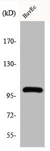 Western Blot analysis of HuvEc cells using Centrobin Polyclonal Antibody
