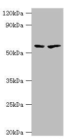 Western blot All lanes: 5-aminolevulinate synthase, erythroid-specific, mitochondrial antibody at 7ug/ml Lane 1: 293T whole cell lysate Lane 2: Mouse brain tissue Secondary Goat polyclonal to rabbit IgG at 1/10000 dilution Predicted band size: 65,...