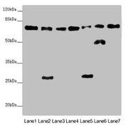Western blot All lanes: ALB antibody at 2 ug/ml Lane 1: Mouse heart tissue Lane 2: Mouse liver tissue Lane 3: Mouse spleen tissue Lane 4: Mouse lung tissue Lane 5: Mouse kidney tissue Lane 6: Mouse brain tissue Lane 7: Mouse skeletal muscle tissue...