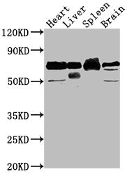 Western Blot Positive WB detected in: Rat heart tissue, Rat liver tissue, Rat spleen tissue, Rat brain tissue All lanes: Alb antibody at 1:2000 Secondary Goat polyclonal to rabbit IgG at 1/50000 dilution Predicted band size: 69 kDa Observed band s...