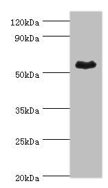 Western blot All lanes: Retinal dehydrogenase 1 antibody at 4ug/ml + Mouse liver tissue Secondary Goat polyclonal to rabbit IgG at 1/10000 dilution Predicted band size: 55 kDa Observed band size: 55 kDa