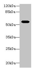 Western blot All lanes: Aldh1a1 antibody at 8µg/ml + Mouse eye tissue Secondary Goat polyclonal to rabbit IgG at 1/10000 dilution Predicted band size: 55 kDa Observed band size: 55 kDa