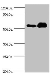Western blot All lanes: Retinal dehydrogenase 2 antibody at 9ug/ml Lane 1: K562 whole cell lysate Lane 2: Mouse liver tissue Secondary Goat polyclonal to rabbit IgG at 1/10000 dilution Predicted band size: 57, 54, 55, 47 kDa Observed band size: 57...