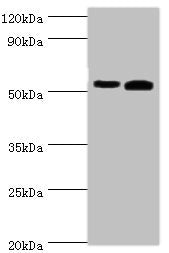 Western blot All lanes: Retinal dehydrogenase 2 antibody at 14ug/ml Lane 1: K562 whole cell lysate Lane 2: Mouse liver tissue Secondary Goat polyclonal to rabbit IgG at 1/10000 dilution Predicted band size: 57, 54, 55, 47 kDa Observed band size: 5...
