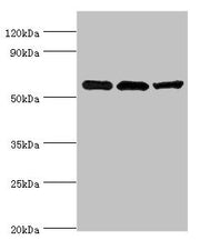 Western blot All lanes: Aldehyde dehydrogenase X, mitochondrial antibody at 4ug/ml Lane 1: Hela whole cell lysate Lane 2: Rat brain tissue Lane 3: HepG2 whole cell lysate Secondary Goat polyclonal to rabbit IgG at 1/10000 dilution Predicted band s...