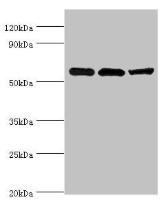 Western blot All lanes: Aldehyde dehydrogenase X, mitochondrial antibody at 4ug/ml Lane 1: Hela whole cell lysate Lane 2: Rat brain tissue Lane 3: HepG2 whole cell lysate Secondary Goat polyclonal to rabbit IgG at 1/10000 dilution Predicted band s...