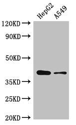 Western Blot Positive WB detected in: HepG2 whole cell lysate, A549 whole cell lysate All lanes: AMD1 antibody at 2.5µg/ml Secondary Goat polyclonal to rabbit IgG at 1/50000 dilution Predicted band size: 39, 22 kDa Observed band size: 39 kDa