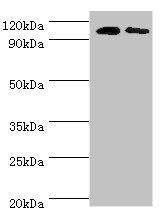 Western blot All lanes: Cytosolic 10-formyltetrahydrofolate dehydrogenase antibody at 8ug/ml Lane 1: Mouse liver tissue Lane 2: Mouse gonad tissue Secondary Goat polyclonal to rabbit IgG at 1/10000 dilution Predicted band size: 99, 88, 100, 56 kDa...