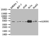 Western Blot Positive WB detected in:RAW264.7 whole cell lysate, MCF7 whole cell lysate, K549 whole cell lysate, Hela whole cell lysate, HepG2 whole cell lysate All lanes:ALDH3B1 Antibody at 1:1000 Secondary Goat polyclonal to rabbit IgG at 1/5000...