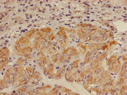 Immunohistochemistry of paraffin-embedded human adrenal gland tissue using CSB-PA001575LA01HU at dilution of 1:100