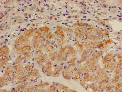 Immunohistochemistry of paraffin-embedded human adrenal gland tissue using CSB-PA001575LA01HU at dilution of 1:100