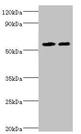 Western blot All lanes: ALDH4A1 antibody at 13µg/ml Lane 1: K562 whole cell lysate Lane 2: 293T whole cell lysate Secondary Goat polyclonal to rabbit IgG at 1/10000 dilution Predicted band size: 62, 56, 57 kDa Observed band size: 62 kDa