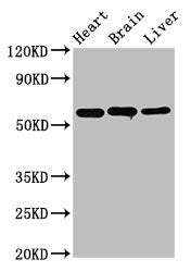 Western Blot Positive WB detected in: Rat heart tissue, Rat brain tissue, Mouse liver tissue All lanes: ALDH5A1 antibody at 3.2µg/ml Secondary Goat polyclonal to rabbit IgG at 1/50000 dilution Predicted band size: 58, 59 kDa Observed band size: 58...