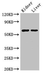 Western Blot Positive WB detected in: Mouse kidney tissue, Mouse liver tissue All lanes: ALDH6A1 antibody at 2.5ug/ml Secondary Goat polyclonal to rabbit IgG at 1/50000 dilution Predicted band size: 58, 57 kDa Observed band size: 58 kDa