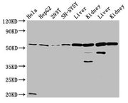 Western Blot Positive WB detected in: Hela whole cell lysate, HepG2 whole cell lysate, 293T whole cell lysate, SH-SY5Y whole cell lysate, Rat liver tissue, Rat kidney tissue, Mouse liver tissue, Mouse kidney tissue All lanes: ALDH7A1 antibody at 4...