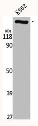 Western Blot analysis of K562 cells using CEP290 Polyclonal Antibody