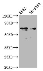 Western Blot Positive WB detected in: K562 whole cell lysate, SH-SY5Y whole cell lysate All lanes: ALOX12 antibody at 3.53µg/ml Secondary Goat polyclonal to rabbit IgG at 1/50000 dilution Predicted band size: 76 kDa Observed band size: 76 kDa