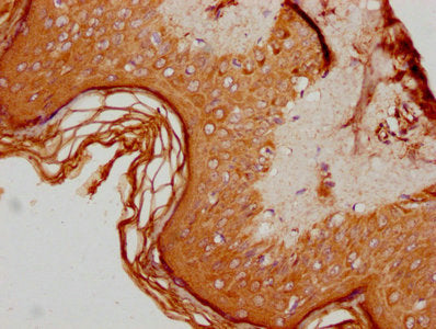 IHC image of CSB-PA001618LA01HU diluted at 1:600 and staining in paraffin-embedded human skin tissue performed on a Leica BondTM system. After dewaxing and hydration, antigen retrieval was mediated by high pressure in a citrate buffer (pH 6.0). Se...