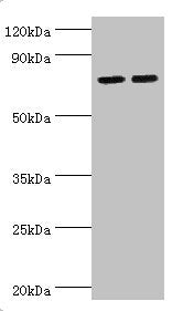 Western blot All lanes: Arachidonate 15-lipoxygenase B antibody at 11ug/ml Lane 1: MCF-7 whole cell lysate Lane 2: 293T whole cell lysate Secondary Goat polyclonal to rabbit IgG at 1/10000 dilution Predicted band size: 76, 68, 70, 73 kDa Observed...